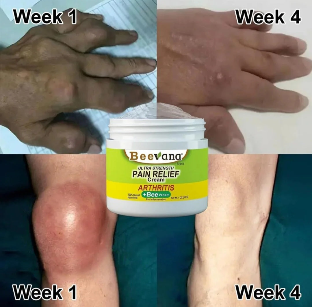Bee Venom Pain Relief Cream (BUY1 GET1) FREE